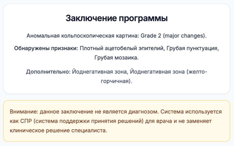 Рис. 5. Образец кольпоскопического заключения с перечнем выявленных признаков.